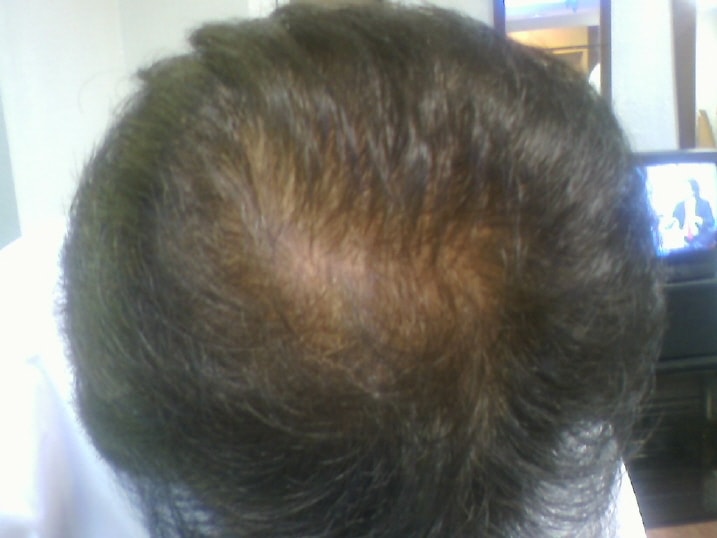 정수리와 엠자..4개월 간의 변화모습입니다.