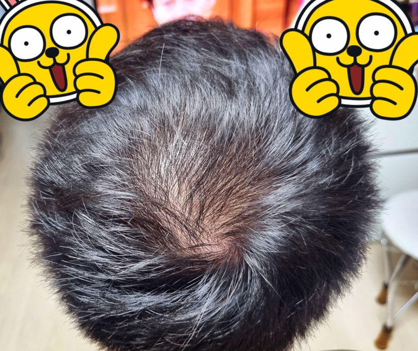 22년 9월 현재 복용 중