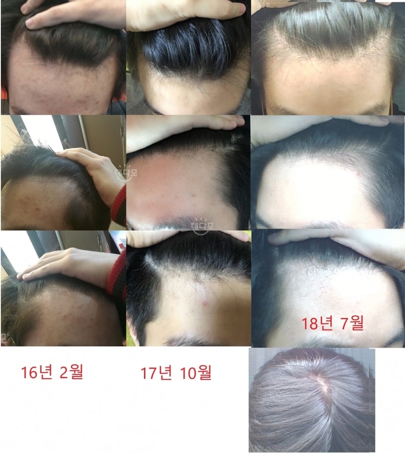 16년2월~18년7월