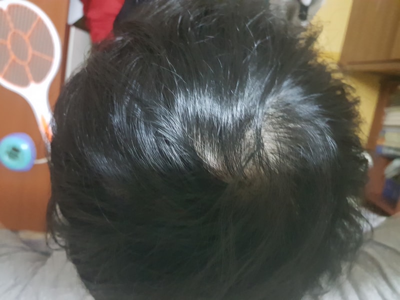 Monde Jung第5年后期