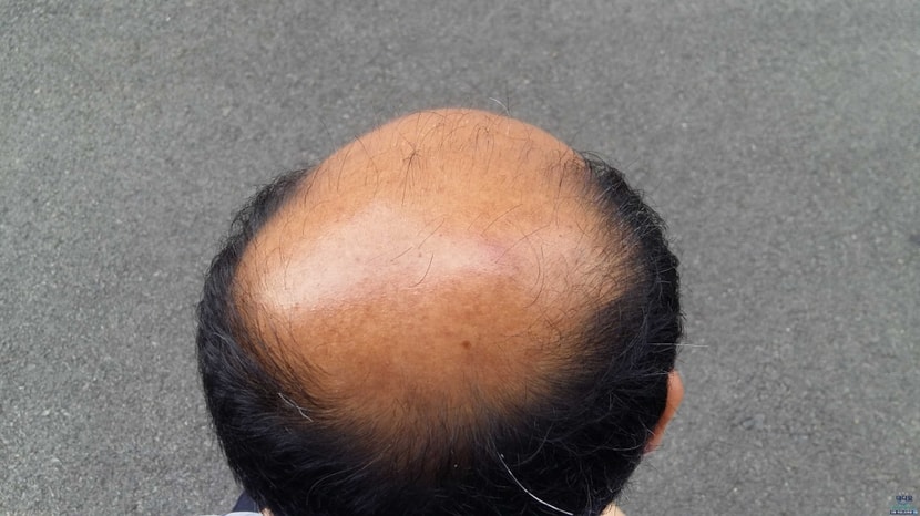 약 먹기 전 사진