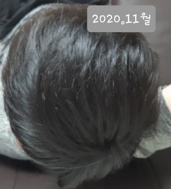 최근 머리상태입니다.