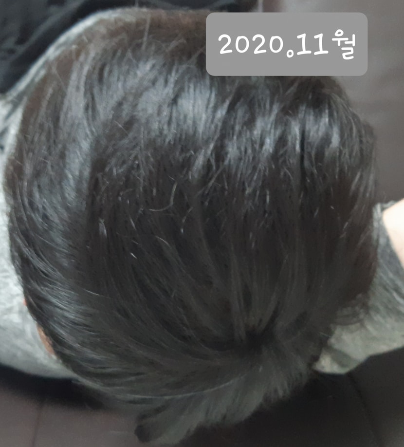 최근 머리상태입니다.
