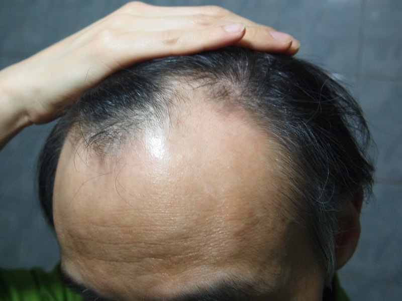 从Abodat拷贝药（杜仲醇+柯尔米诺克）开始。