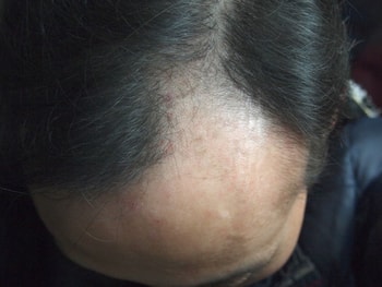 20년 4월6일 머리감고 건조만 한 상태