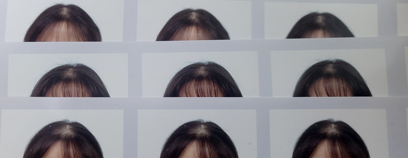 여성탈모 미녹시딜 후기
