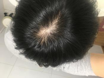 약 처방 받은날