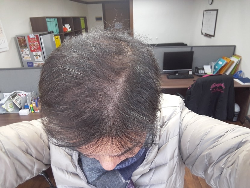 2018.01.09 (7개월후 현재)