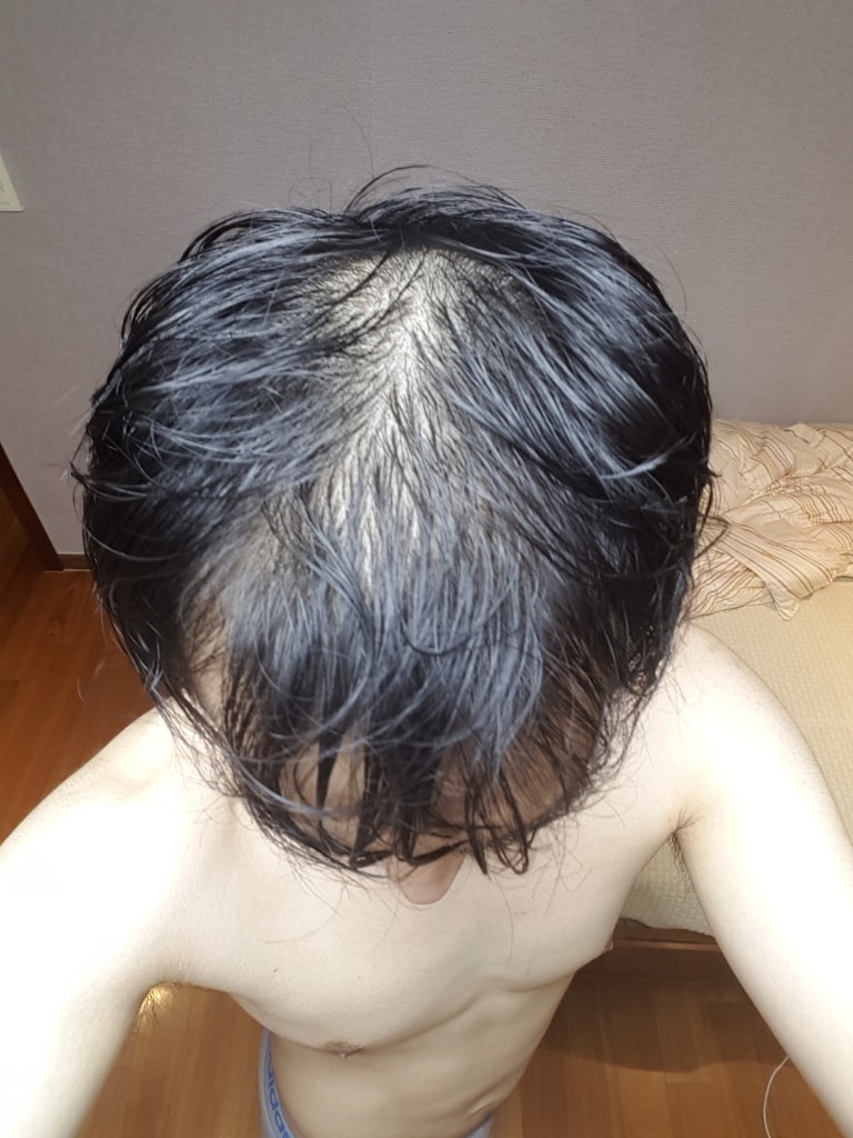 복용 및 도포 전