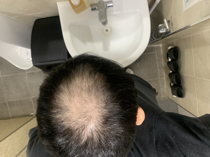 복용전