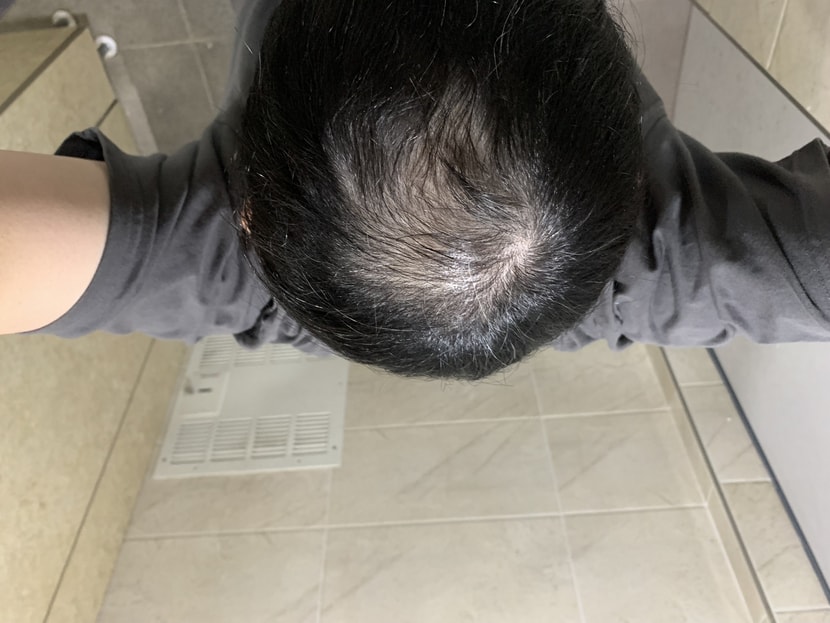 3달차