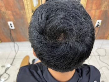 복용 6개월차