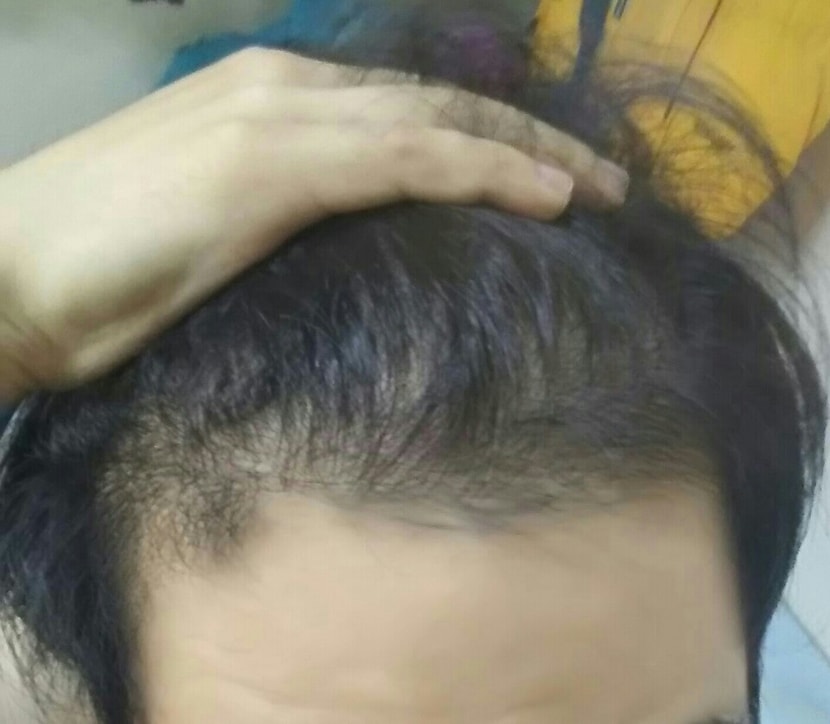 3개월 약간 지남