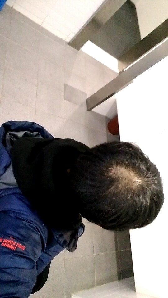 프로페시아 두 달 복용 후기입니다