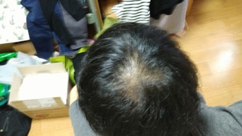 복용 초기3