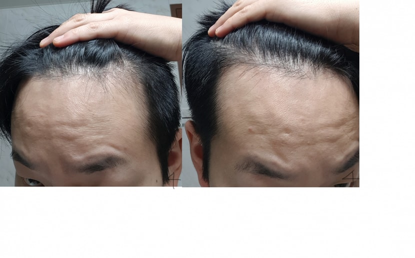 4번 사진 2019년 11월 4일경