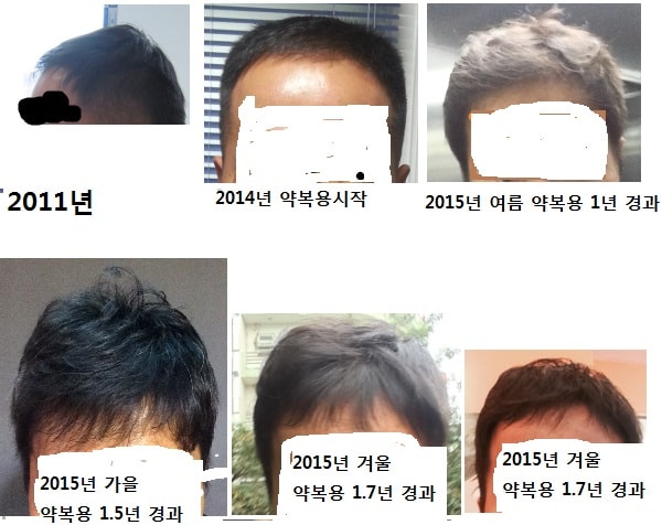 1년반이 훌쩍 지났네요.