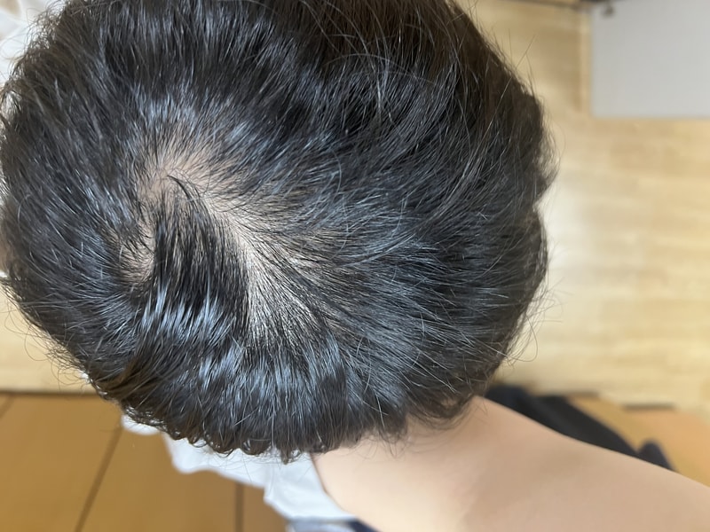 피나온정 한달차 입니다.