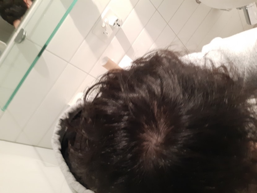 6달반 현재