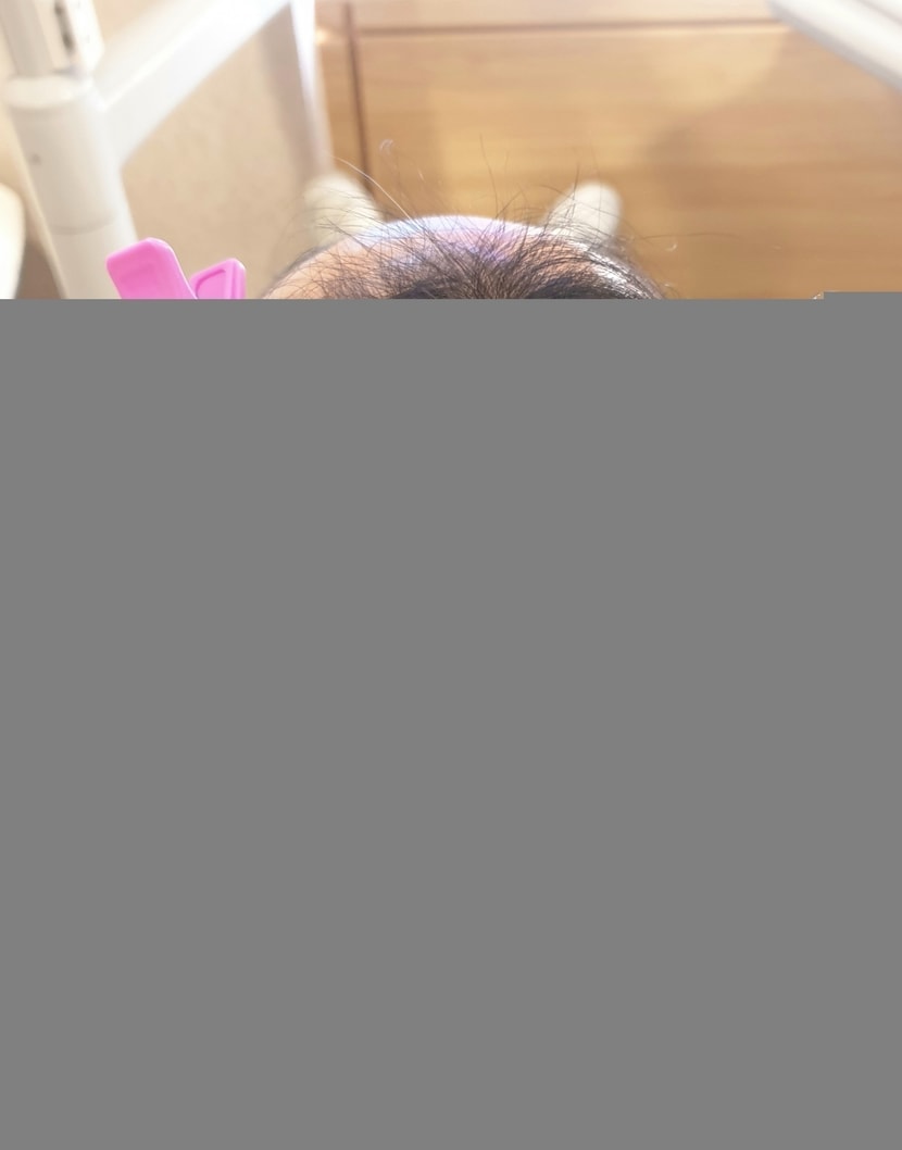 14회차 치료1