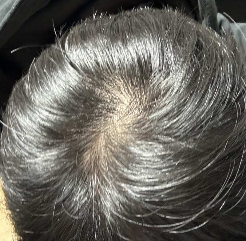 모나시아 1개월 피나온 3개월 차입니다