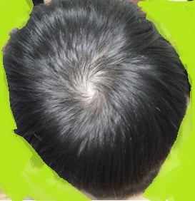 약복용 1년 후기임니다!!