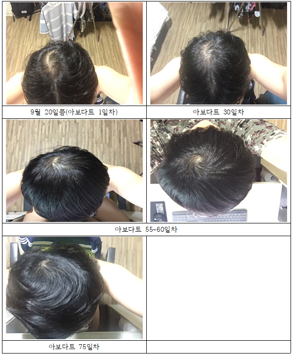 일단은 80~85% 정도 복구되었습니다.