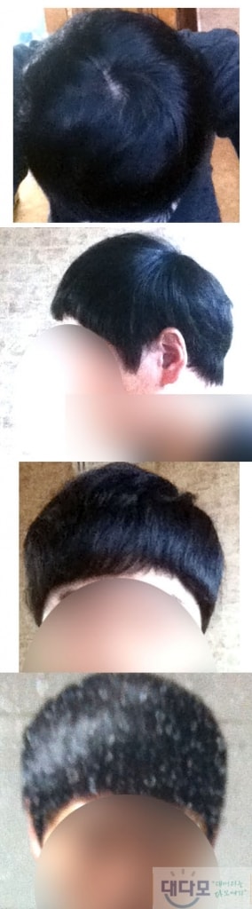 1년