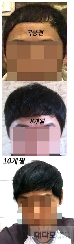 10개월