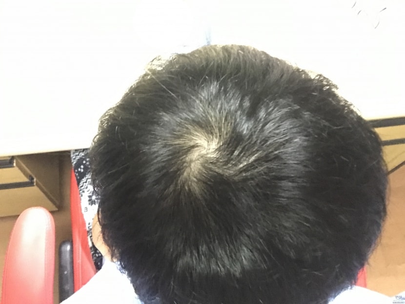 1개월 차