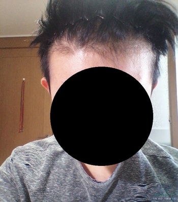 m자 초기 사진 추가