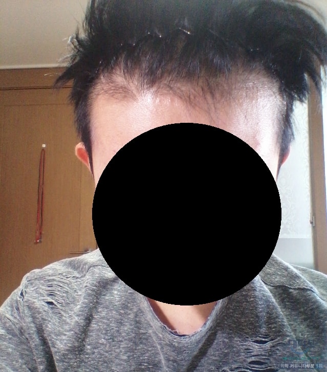 m자 초기 사진 추가