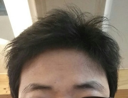 이식부