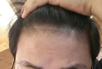 이식부