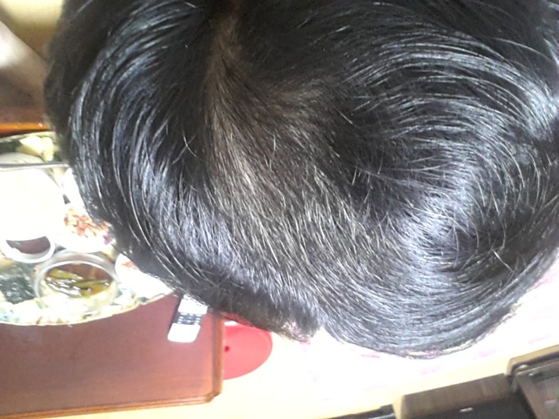 服用普卡3个半月后半期！再服用的话会更好吧？？？