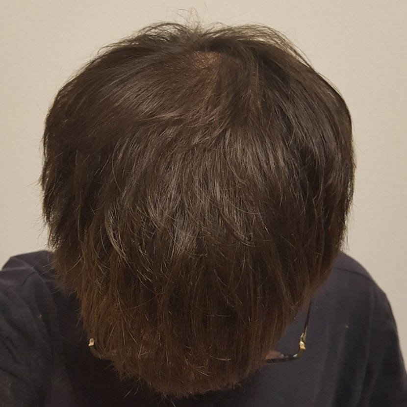 138일 정수리(앞)