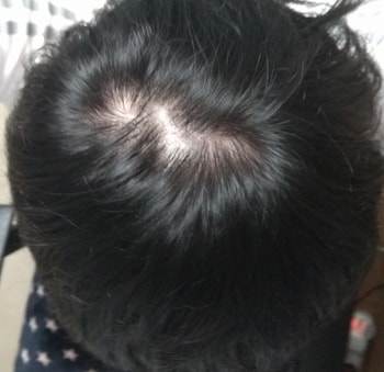 일주일 전