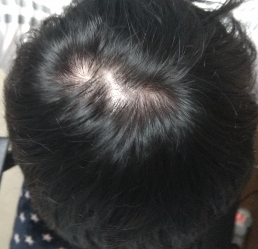 일주일 전