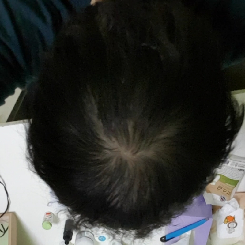 吃2年饭后换成了都塔已经4个月了