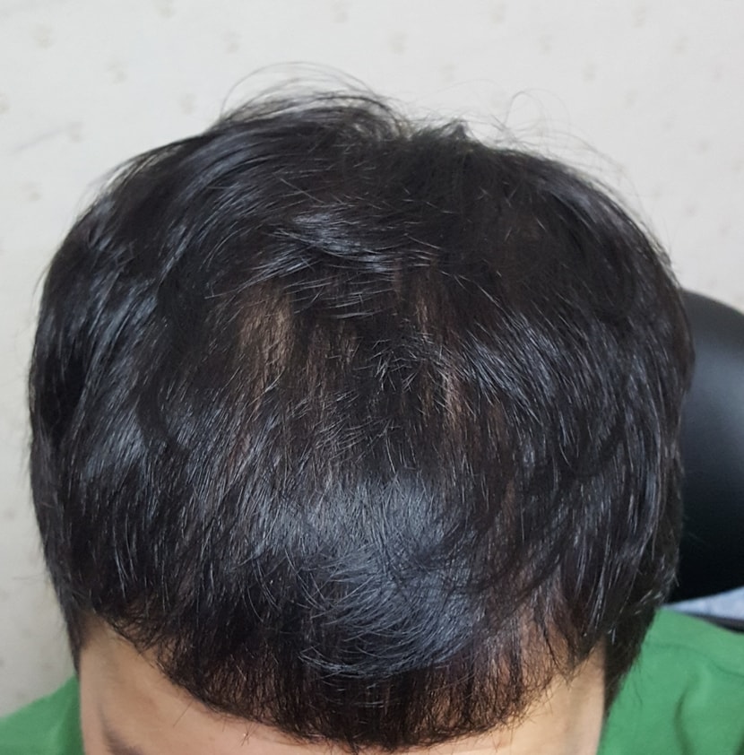 2달