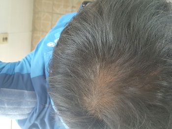 20160331