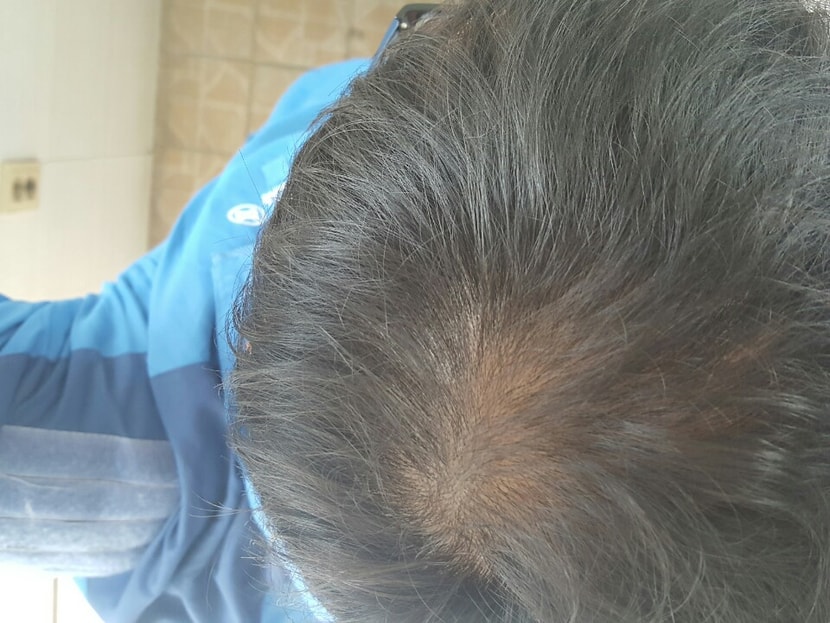 20160331