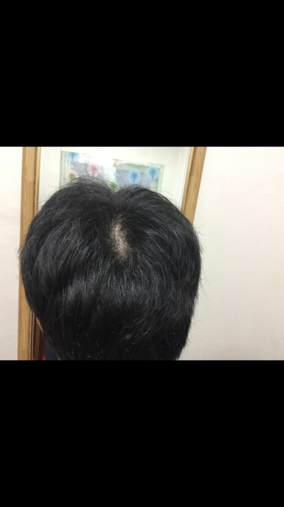 현재
