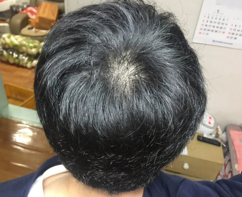 현재