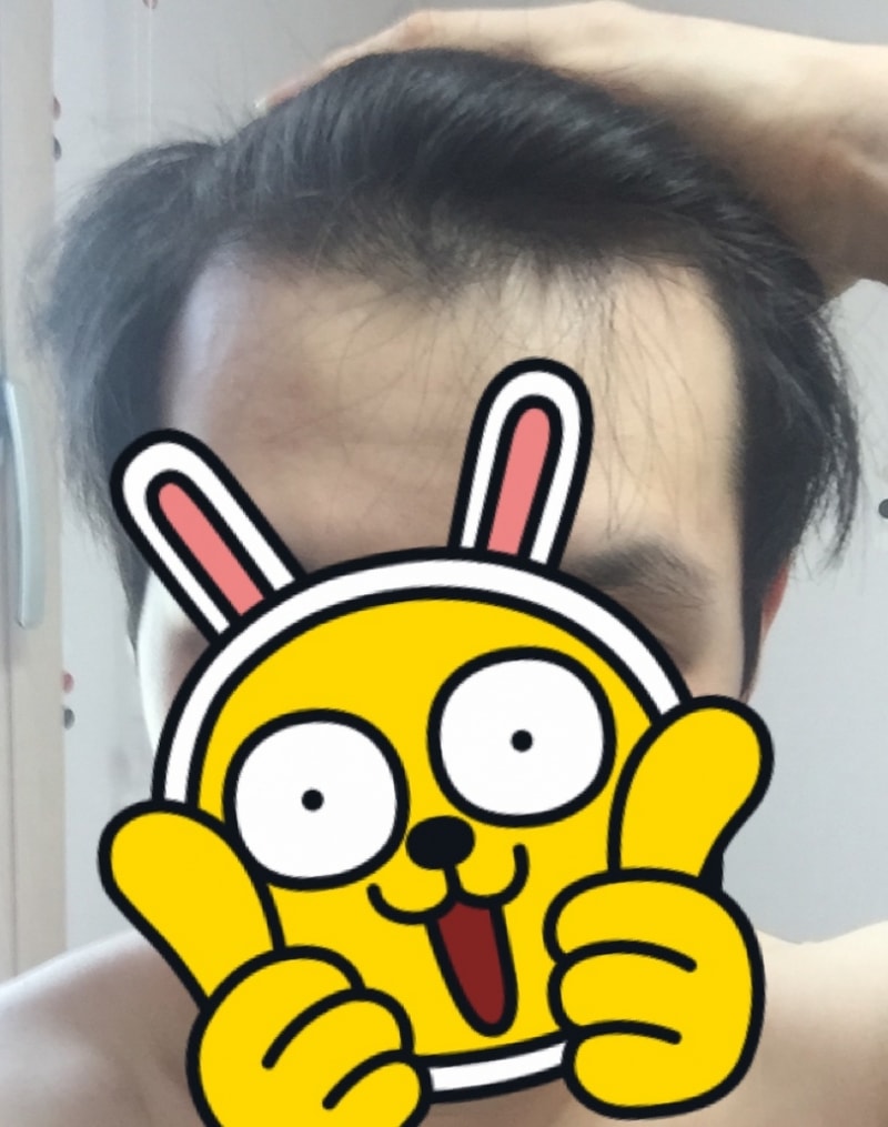 아보다트 2년차 후기입니다