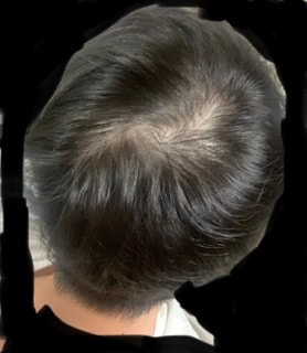 20중반 프페 오늘부터 시작합니다