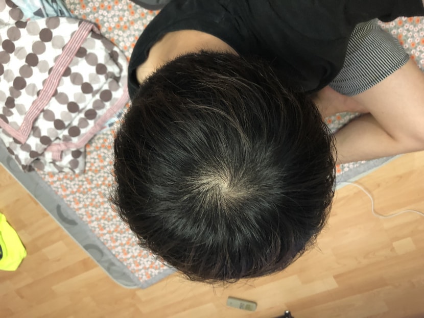 복용 2년 현재