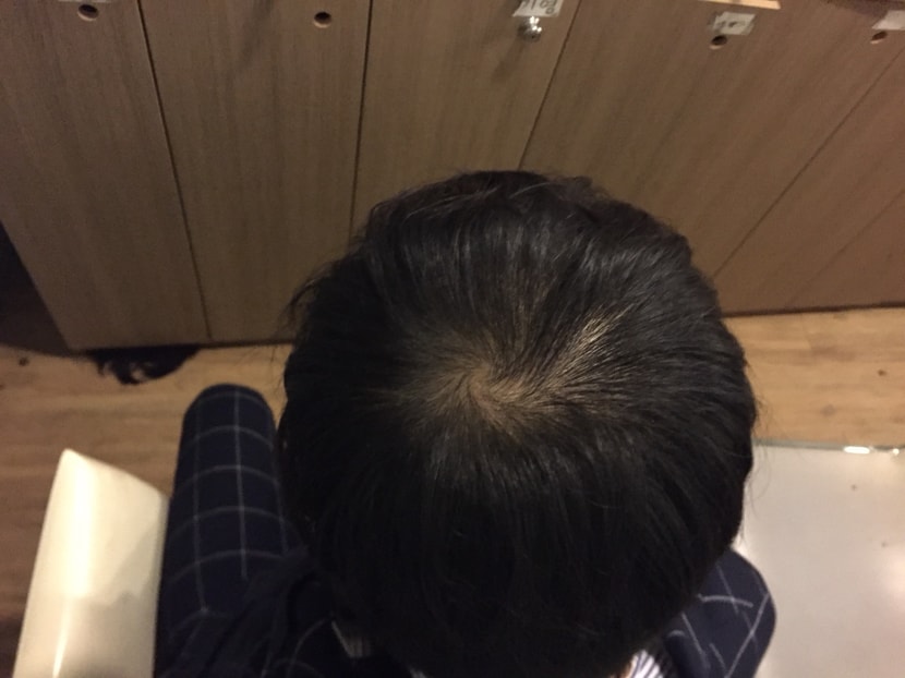 복용 1~2개월