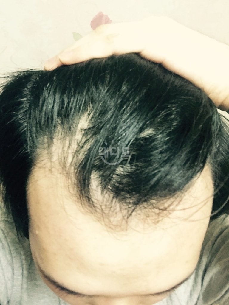 Abodat Day 845 Review (Legend)