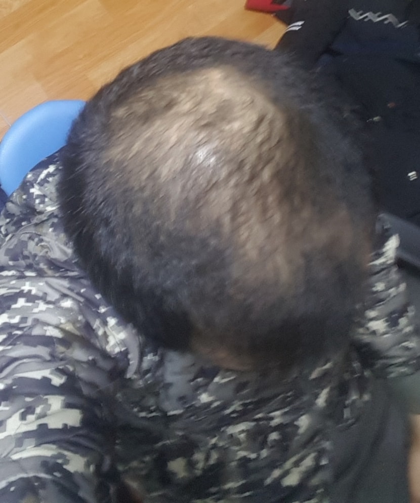 머리가 너무빠져서 반삭했을때...